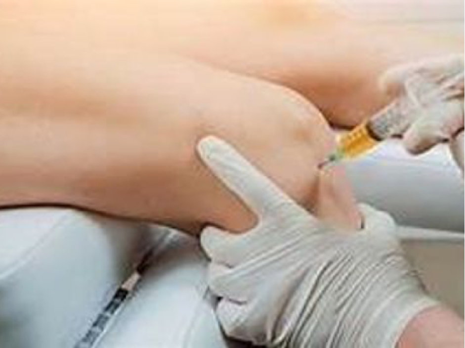 PRP Therapy